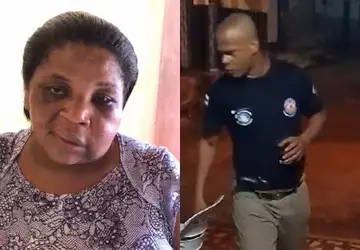 VÍDEO: Mulher agredida por PM no interior baiano aparece com rosto inchado